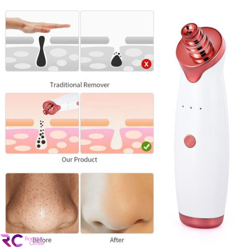 میکرودرم خانگی وکیوم صورت موهایر Moehair MO-9021 - Image 5